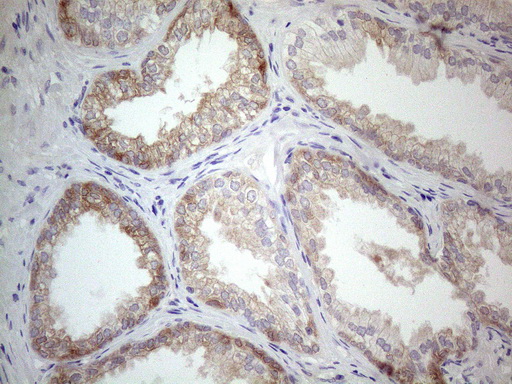 m16218 anti plcxd1 mouse monoclonal antibody clone id oti2d7 ihc testing 3