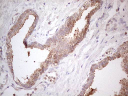 m16218 anti plcxd1 mouse monoclonal antibody clone id oti2d7 ihc testing 4