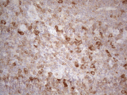 m16218 anti plcxd1 mouse monoclonal antibody clone id oti2d7 ihc testing 5