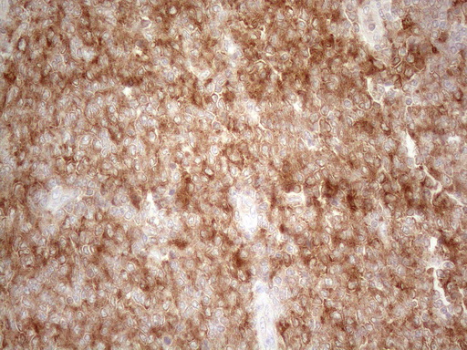 m16218 anti plcxd1 mouse monoclonal antibody clone id oti2d7 ihc testing 6