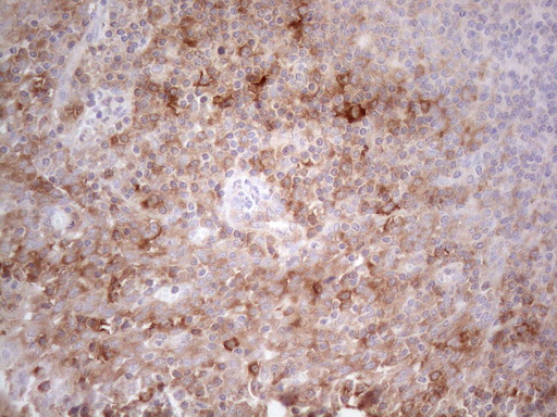 m16218 anti plcxd1 mouse monoclonal antibody clone id oti2d7 ihc testing 7