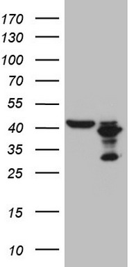 m16218 anti plcxd1 mouse monoclonal antibody clone id oti2d7 wb testing 1