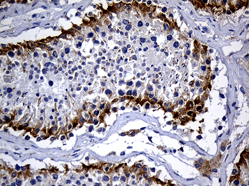 m16262 anti dhrs4l2 mouse monoclonal antibody clone id oti4a10 ihc testing 4