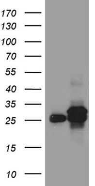 m16262 anti dhrs4l2 mouse monoclonal antibody clone id oti4a10 wb testing 1
