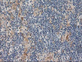 Immunohistochemical staining of paraffin-embedded Human lymphoma tissue using anti-CXorf26 mouse monoclonal antibody