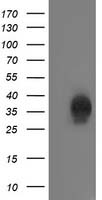 HEK293T cells were transfected with the pCMV6-ENTRY control (Left lane) or pCMV6-ENTRY CXorf26 (Right lane) cDNA for 48 hrs and lysed