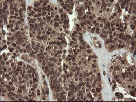 m16324 anti cxorf26 pbdc1 mouse monoclonal antibody clone id oti5a11 ihc testing 4