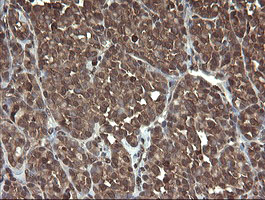 m16324 anti cxorf26 pbdc1 mouse monoclonal antibody clone id oti5a11 ihc testing 5