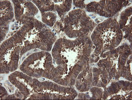 m16324 anti cxorf26 pbdc1 mouse monoclonal antibody clone id oti5a11 ihc testing 6
