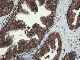 m16324 anti cxorf26 pbdc1 mouse monoclonal antibody clone id oti5a11 ihc testing 7