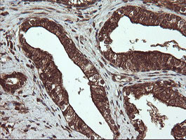 m16324 anti cxorf26 pbdc1 mouse monoclonal antibody clone id oti5a11 ihc testing 8