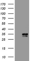 HEK293T cells were transfected with the pCMV6-ENTRY control (Left lane) or pCMV6-ENTRY CXorf26 (Right lane) cDNA for 48 hrs and lysed