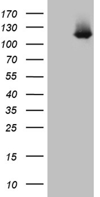 HEK293T cells were transfected with the pCMV6-ENTRY control (Left lane) or pCMV6-ENTRY LONRF3 (Right lane) cDNA for 48 hrs and lysed. Equivalent amounts of cell lysates (5 ug per lane) were separated by SDS-PAGE and immunoblotted with anti-LONRF3 (1:2000).