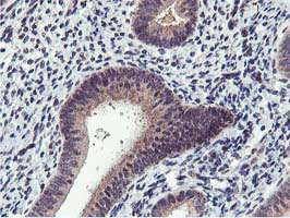 Immunohistochemical staining of paraffin-embedded Human endometrium tissue within the normal limits using anti-MIER2 mouse monoclonal antibody