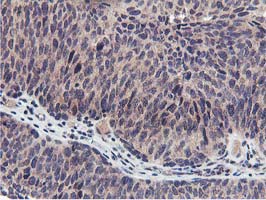 m16361 anti mier2 mouse monoclonal antibody clone id oti3g7 ihc testing 4