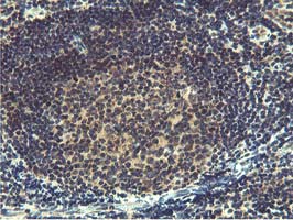 m16361 anti mier2 mouse monoclonal antibody clone id oti3g7 ihc testing 5