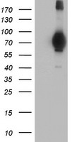 HEK293T cells were transfected with the pCMV6-ENTRY control (Left lane) or pCMV6-ENTRY MIER2 (Right lane) cDNA for 48 hrs and lysed