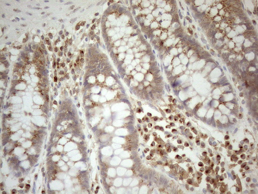 m16419 anti znf69 mouse monoclonal antibody clone id oti3c3 ihc testing 10
