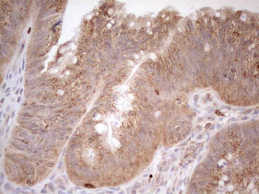 m16419 anti znf69 mouse monoclonal antibody clone id oti3c3 ihc testing 4