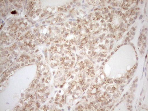 m16419 anti znf69 mouse monoclonal antibody clone id oti3c3 ihc testing 5