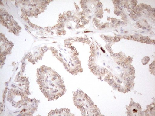 m16419 anti znf69 mouse monoclonal antibody clone id oti3c3 ihc testing 6