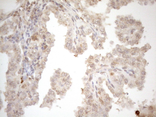 m16419 anti znf69 mouse monoclonal antibody clone id oti3c3 ihc testing 7