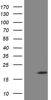 HEK293T cells were transfected with the pCMV6-ENTRY control (Left lane) or pCMV6-ENTRY ZNF69 (Right lane) cDNA for 48 hrs and lysed