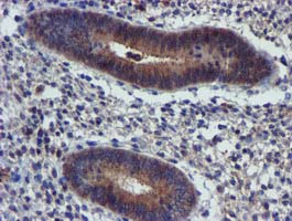 Immunohistochemical staining of paraffin-embedded Human endometrium tissue within the normal limits using anti-PIH1D2 mouse monoclonal antibody. (Heat-induced epitope retrieval by 10mM citric buffer