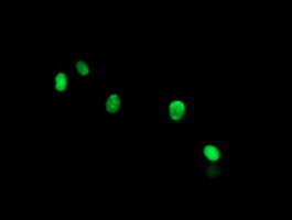 Anti-THAP6 mouse monoclonal antibody (M16470-1) immunofluorescent staining of COS7 cells transiently transfected by pCMV6-ENTRY THAP6. Anti-THAP6 mouse monoclonal antibody (M16470-1) immunofluorescent staining of COS7 cells transiently transfected by pCMV6-ENTRY THAP6.