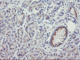 m16470 anti thap6 mouse monoclonal antibody clone id oti1f6 ihc testing 2