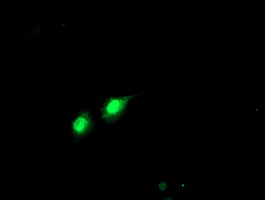 m16476 anti phf21b mouse monoclonal antibody clone id oti3d1 if testing 11