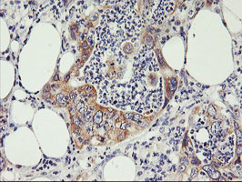 m16476 anti phf21b mouse monoclonal antibody clone id oti3d1 ihc testing 4