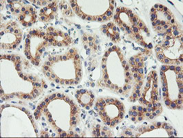 m16476 anti phf21b mouse monoclonal antibody clone id oti3d1 ihc testing 5