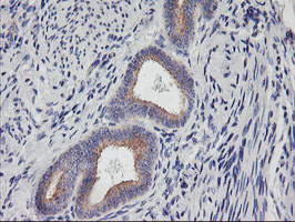 m16476 anti phf21b mouse monoclonal antibody clone id oti3d1 ihc testing 6