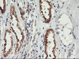 m16476 anti phf21b mouse monoclonal antibody clone id oti3d1 ihc testing 8