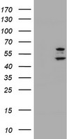 HEK293T cells were transfected with the pCMV6-ENTRY control (Left lane) or pCMV6-ENTRY PHF21B (Right lane) cDNA for 48 hrs and lysed