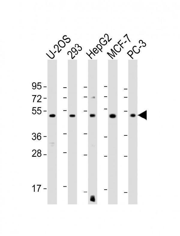 All lanes : Anti-EEF1A1P5 Antibody (C-Term) at 1:1000-1:2000 dilutionLane 1: U-2OS whole cell lysateLane 2: 293 whole cell lysateLane 3: HepG2 whole cell lysateLane 4: MCF-7 whole cell lysateLane 5: PC-3 whole cell lysateLysates/proteins at 20 µg per lane