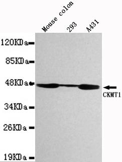 m16590 ckmt1a primary antiboties wb testing 1