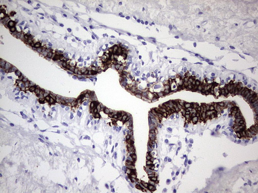 m16600 1 anti c10orf63 enkur mouse monoclonal antibody clone id oti6c10 ihc testing 10