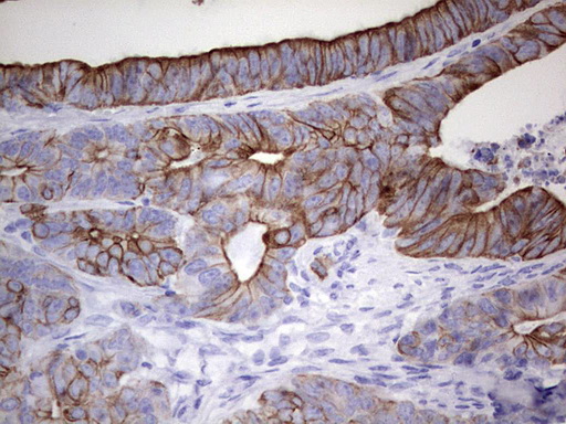 m16600 1 anti c10orf63 enkur mouse monoclonal antibody clone id oti6c10 ihc testing 11