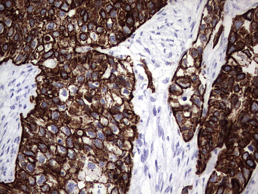 m16600 1 anti c10orf63 enkur mouse monoclonal antibody clone id oti6c10 ihc testing 12
