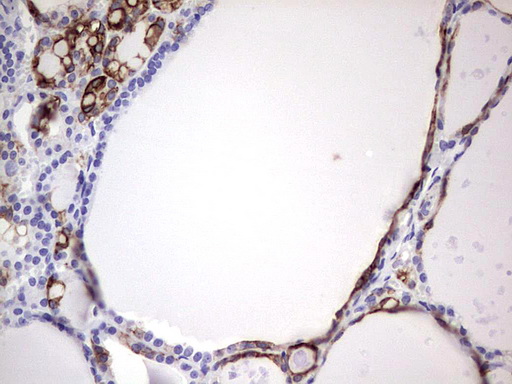 m16600 1 anti c10orf63 enkur mouse monoclonal antibody clone id oti6c10 ihc testing 4