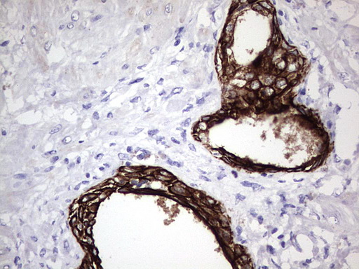 m16600 1 anti c10orf63 enkur mouse monoclonal antibody clone id oti6c10 ihc testing 5