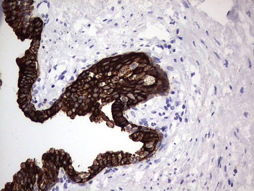 m16600 1 anti c10orf63 enkur mouse monoclonal antibody clone id oti6c10 ihc testing 6