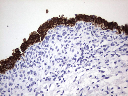m16600 1 anti c10orf63 enkur mouse monoclonal antibody clone id oti6c10 ihc testing 7