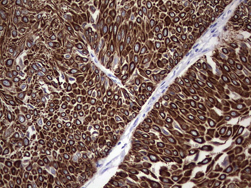 m16600 1 anti c10orf63 enkur mouse monoclonal antibody clone id oti6c10 ihc testing 8
