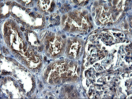 Immunohistochemical staining of paraffin-embedded Human Kidney tissue within the normal limits using anti-ANKMY2 mouse monoclonal antibody. (Heat-induced epitope retrieval by 1 mM EDTA in 10mM Tris Immunohistochemical staining of paraffin-embedded Human Kidney tissue within the normal limits using anti-ANKMY2 mouse monoclonal antibody. (Heat-induced epitope retrieval by 1 mM EDTA in 10mM Tris
