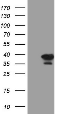HEK293T cells were transfected with the pCMV6-ENTRY control (Left lane) or pCMV6-ENTRY ASB8 (Right lane) cDNA for 48 hrs and lysed. Equivalent amounts of cell lysates (5 ug per lane) were separated by SDS-PAGE and immunoblotted with anti-ASB8 (1:2000).