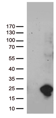 HEK293T cells were transfected with the pCMV6-ENTRY control (Left lane) or pCMV6-ENTRY UBE2NL (Right lane) cDNA for 48 hrs and lysed