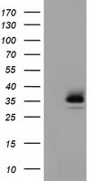 HEK293T cells were transfected with the pCMV6-ENTRY control (Left lane) or pCMV6-ENTRY RFPL1 (Right lane) cDNA for 48 hrs and lysed